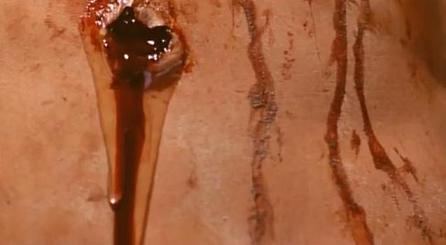 Do Seu lado saiu sangue e água