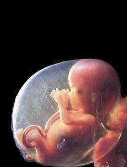 12 semanas – 3 meses